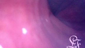 anal endoscope all the way in my transverse colon!