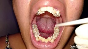 10 days without brushing my teeth. Dirty teeth and lots of saliva? Of course!