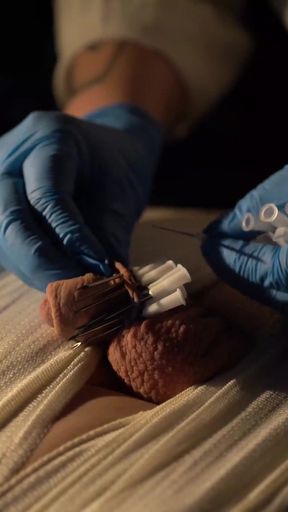 medical play fun, mummification, needle cbt and electro   Clip 1