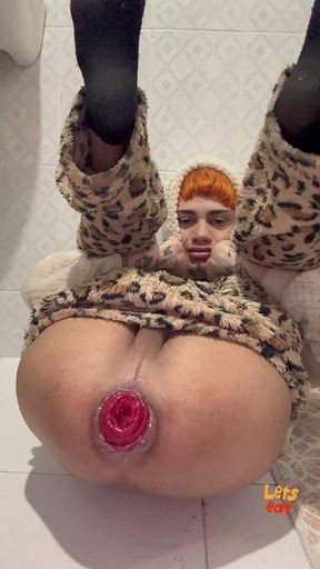 Time to Train This Prolapse