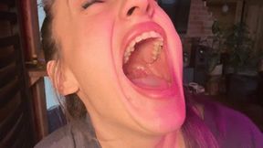 I want to tell you something, but yawning is blocking me