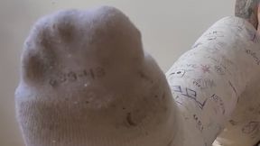 Long Leg Cast with Socks