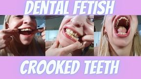 Examining my teeth And crooked teeth