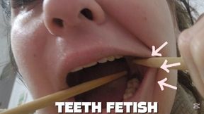 Chopsticks Exploring My Teeth
