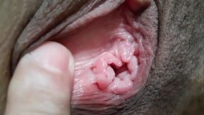 ANALISANDO O BUCET&Atilde_O DA DUDA HUGNEN