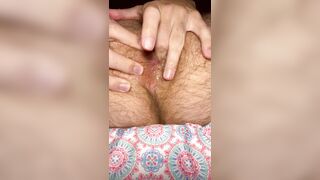 Raw Pinkish Furry Brown sphincter