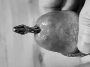 Urethral dilator 10 mm