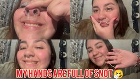 My hands are full of snot