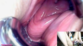 AdalynnX - Endoscope speculum hitachi vib