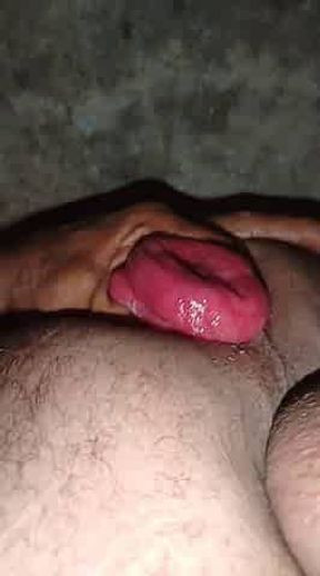 Prolapso my