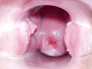 Cervix Display and Speculum Play