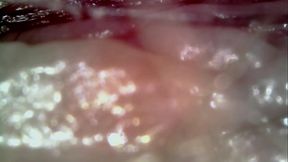 Fertile hairy pussy orgasm with medical microscope