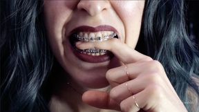 Biting my own fingers - bite, mouth, teeth, braces, fetish ITA
