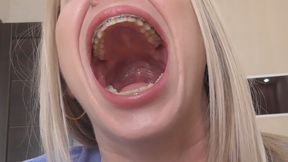 Big stinking throat! MP4