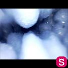 Doll Arden Endoscope