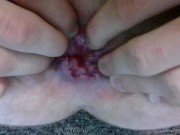 My cute little prolapsing asshole lips squeezing down and on the tip of your massive cock