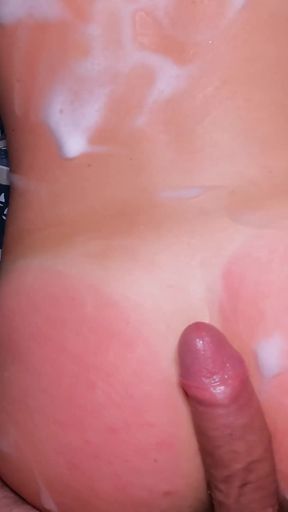 My Stepsister Got Sunburned and Asked for Help!