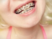 My 2nd day in braces: cleaning by dental floss