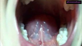 Upclose Inside My Mouth