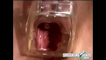 Speculum