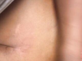 I GOT BANGED ON THE STOVE