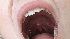 Big mouth yawn! MP4