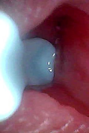 I Couldn&#039;t Believe What Happens Inside the Penis as Sperm Passes Through (endoscopic Footage)