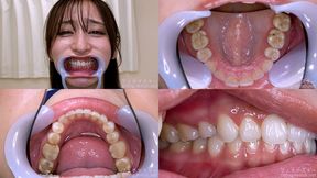 Yuri Adachi - Watching Inside mouth of Japanese cute girl - MOV