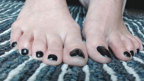 Black toenails closeup toe play