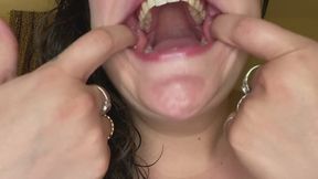 Showing off your new home - Wet Mouth & Throat