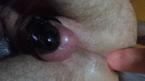 Anal masturbation
