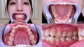 Akari Hanazato - Watching Inside mouth of Japanese cute girl - 1080p