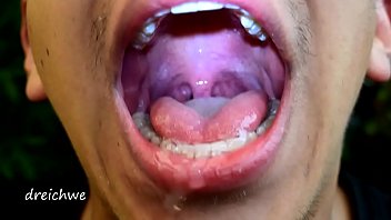 Early morning uvula