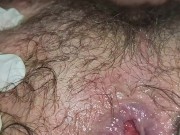 Stretching and gaping my destroyed untrained ass, marbles and gloves play (CLOSEUP)