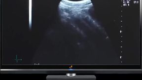 Step daddy Ultrasound Deep Fuck