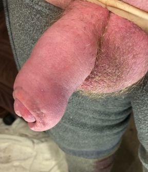 Up close cock and balls.  Uncut veiny dick.