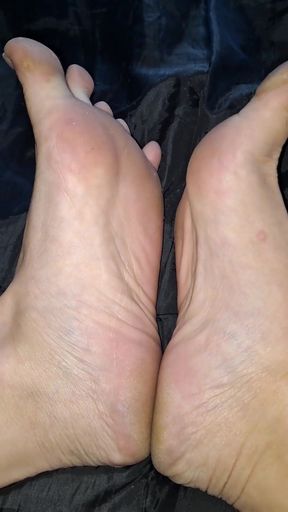 Soles Are so Wrinkly