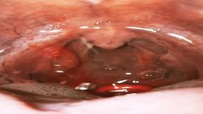 Eating gummies with sparkling water - Experience Vore uvula wide open 4K