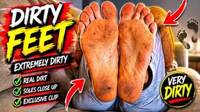 Dirty feet!
