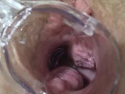 Mature lesbians play in a gynecologist, open the vagina with a medical dilator, examine the cervix.