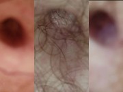 3 Extreme Closeups and Zooms of Belly Button in Multi Cam