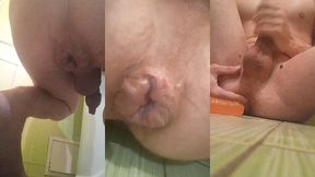 natural lubricant is leaking out of my stretching hemorrhoid anal after fisting with a giant bottle