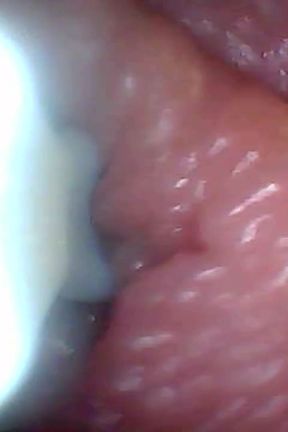 Endoscope Camera Shows the Most Sensitive Parts of the Penis Educational Video