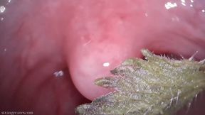 tongue and uvula stinging nettles (720 mp4)