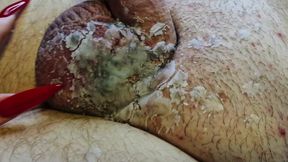 Hot candle wax pours generously onto the BDSM slave's balls and dick. CBT wax play for male genitals