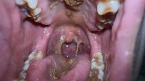 Eating chocolate Close-Up Inside My Mouth - Uvula Full View