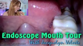 Endoscope Mouth Tour - Jacquelyn Velvets - HD 720 WMV