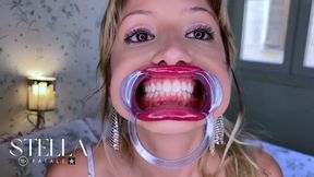 Dental Tools Mouth Exam All Teeth Displayed