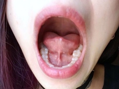 Mouth Examine