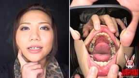 Teeth Obsession Unleashed: Loads of Inlays with Reina Kitamura